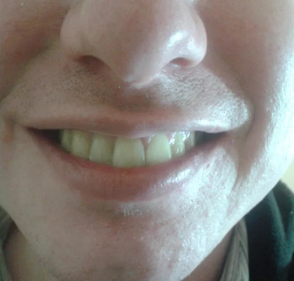 Physical mutations that prove were all one of a kind life is awesome beautiful interesting shocking mind blowing humanity 032922 0