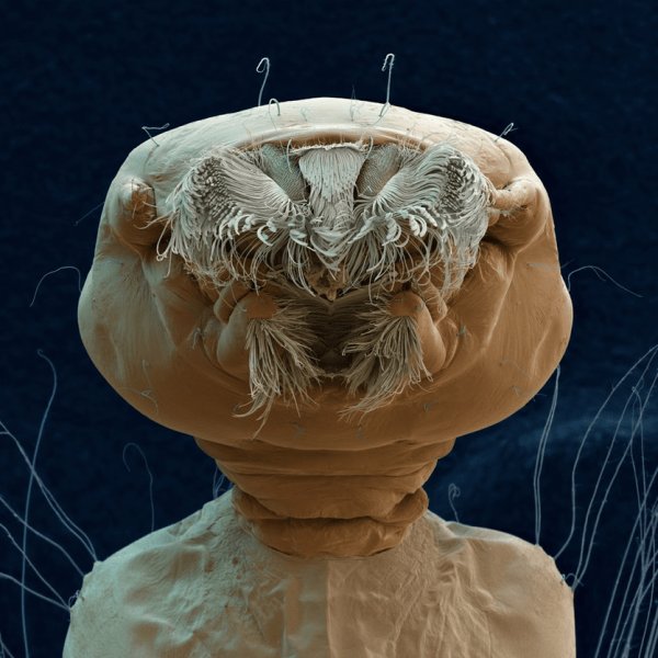 Мир через микроскоп: интересные макрофотографии Мир через микроскоп: интересные макрофотографии