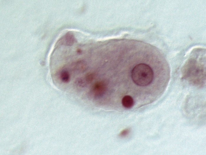 Гиперпаразитизм: Паразиты паразитов в паразитах! Безумие? Нет, без таких «матрёшек» экосистема не сможет функционировать Гиперпаразитизм: Паразиты паразитов в паразитах! Безумие? Нет, без таких «матрёшек» экосистема не сможет функционировать