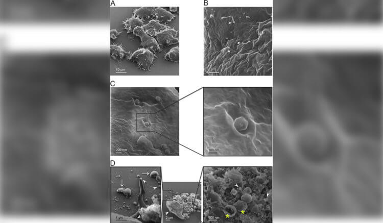 Самый большой вирус в мире. Прикрепление вируса Jyvaskylavirus к клеткам A. castellanii под микроскопом. Источник изображения: popsci.com. Фото.