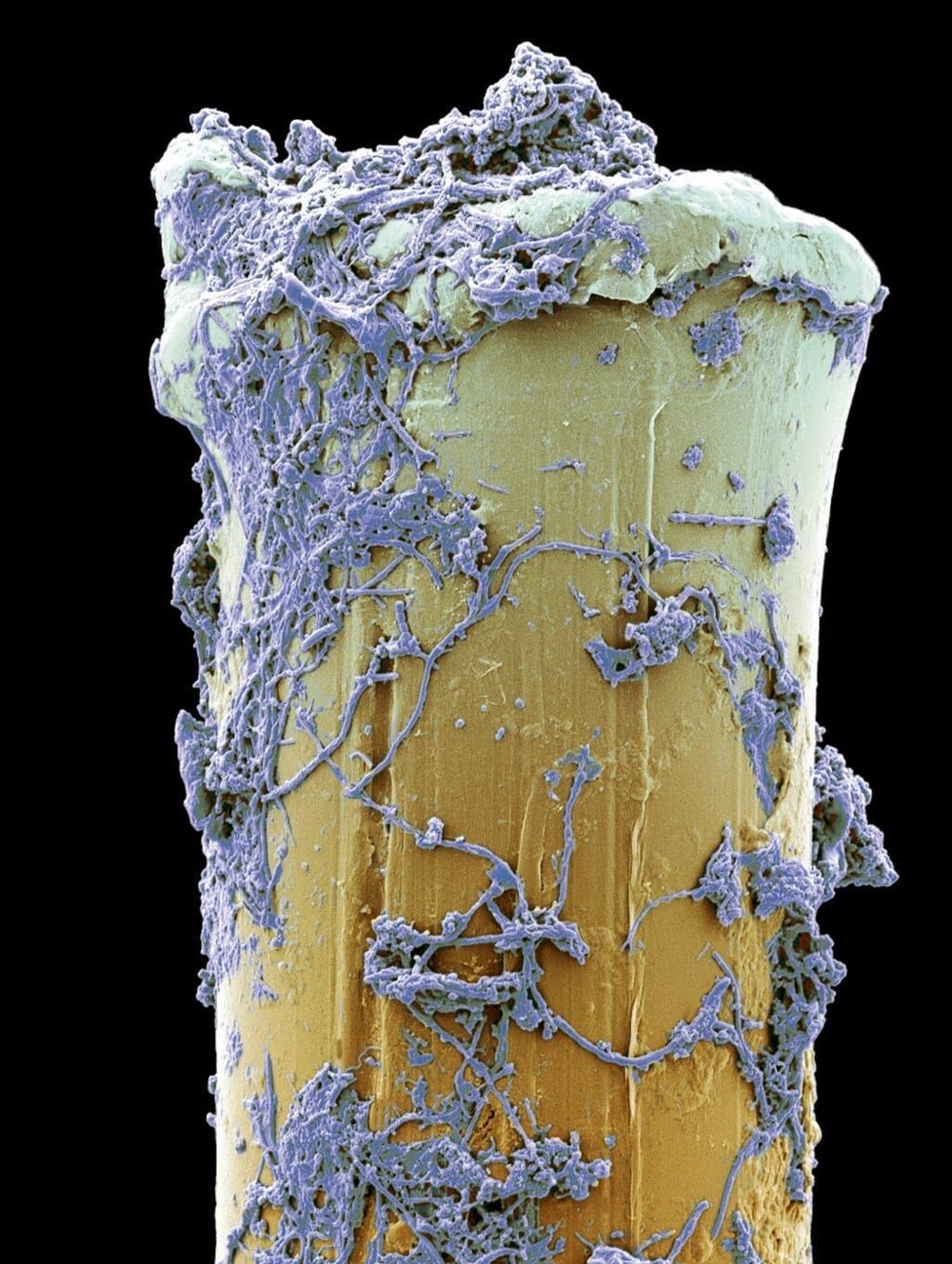 5. Бактерии на щетине