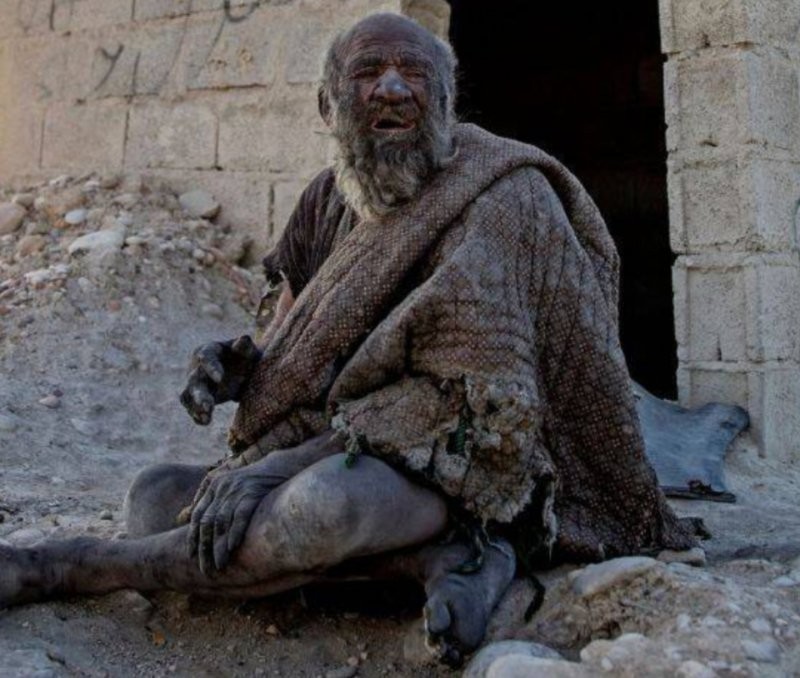 1. Иран и самый грязный человек в мире 1. Иран и самый грязный человек в мире