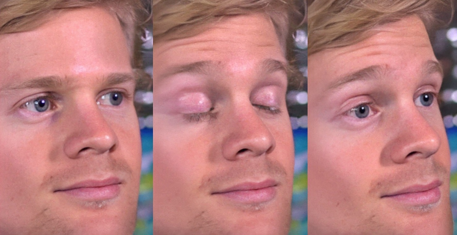 Почему мы не замечаем, как моргаем? За 80 лет жизни человек в среднем тратит 3,5 года только на моргание. Фото.